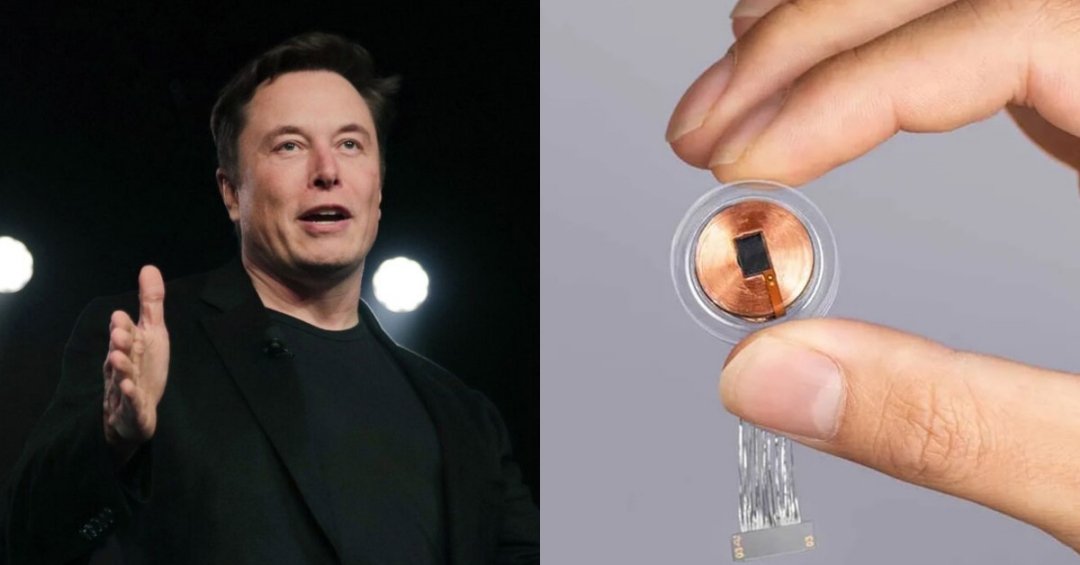 Neuralink要进行晶片人体实验！Elon Musk自愿成为受试者！