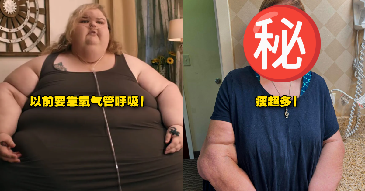 超励志！37岁女子体重直逼330kg！胖到不能自行走动，要靠氧气管才能呼吸！她用2年成功减掉200kg！